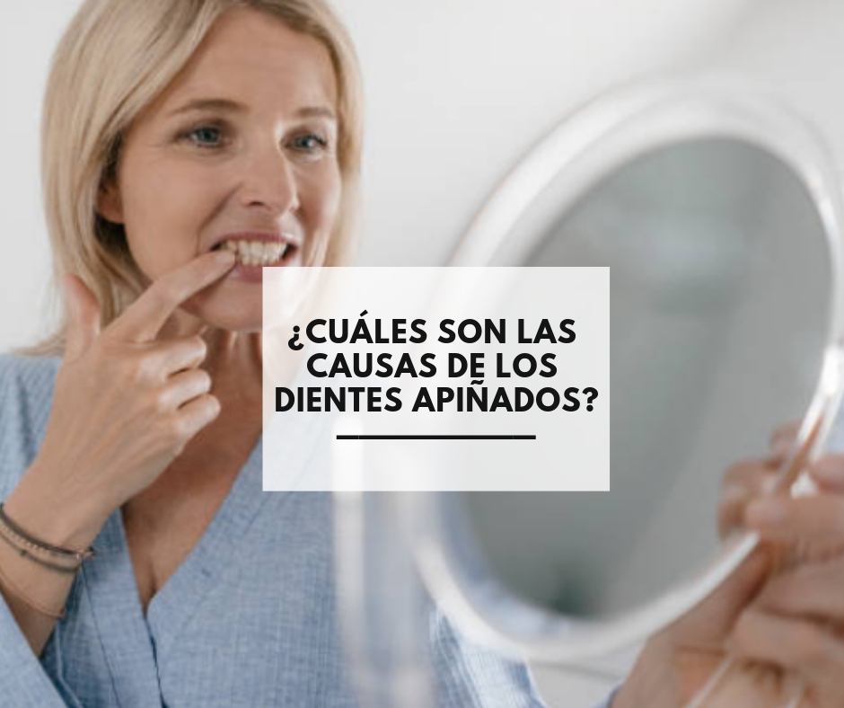 Qué beneficios tiene el Invisalign frente a otros tratamientos - Dres. Pampols y Brotons