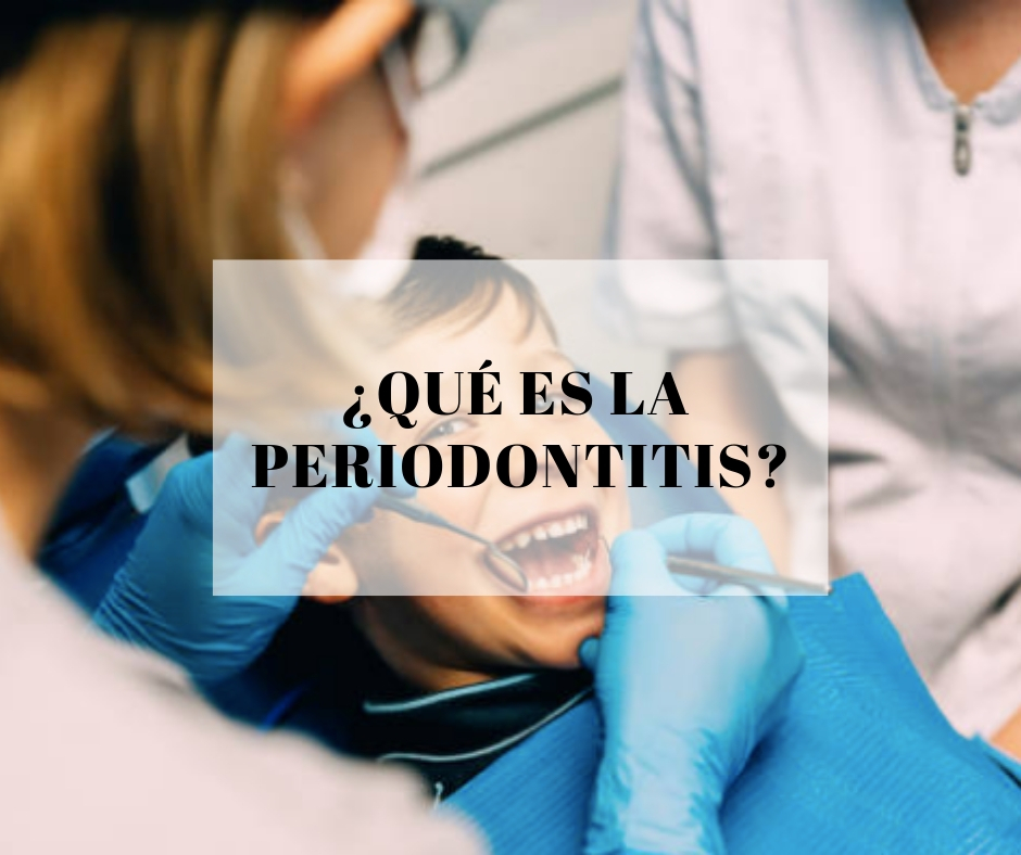 que es la periodontitis - Dres. Pampols y Brotons