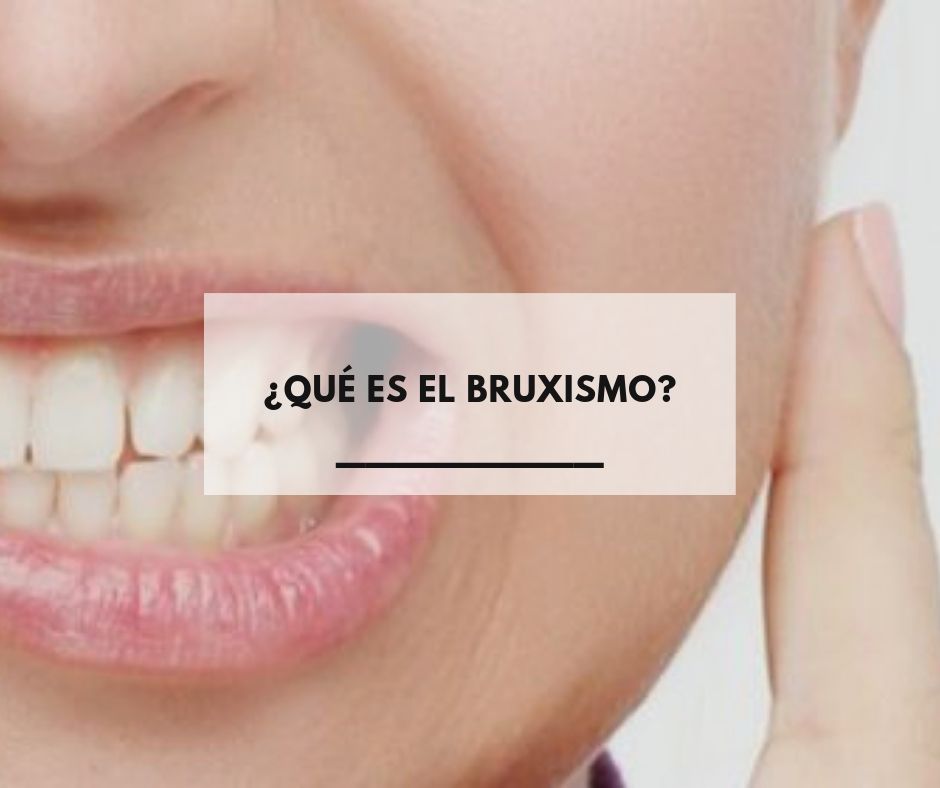 ¿Qué es el bruxismo?